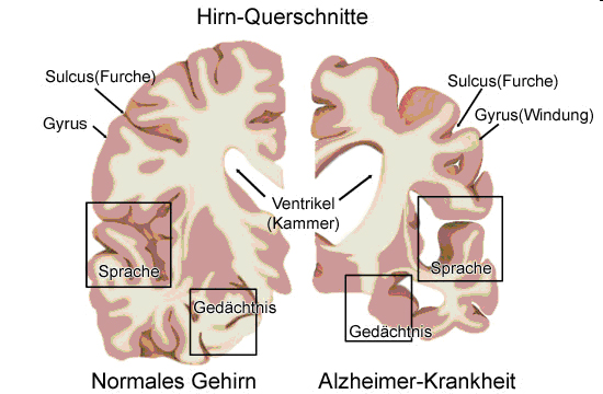 Hirn_Querschnitt.jpg