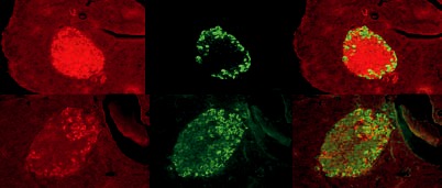 Teaserbild eines Projekts